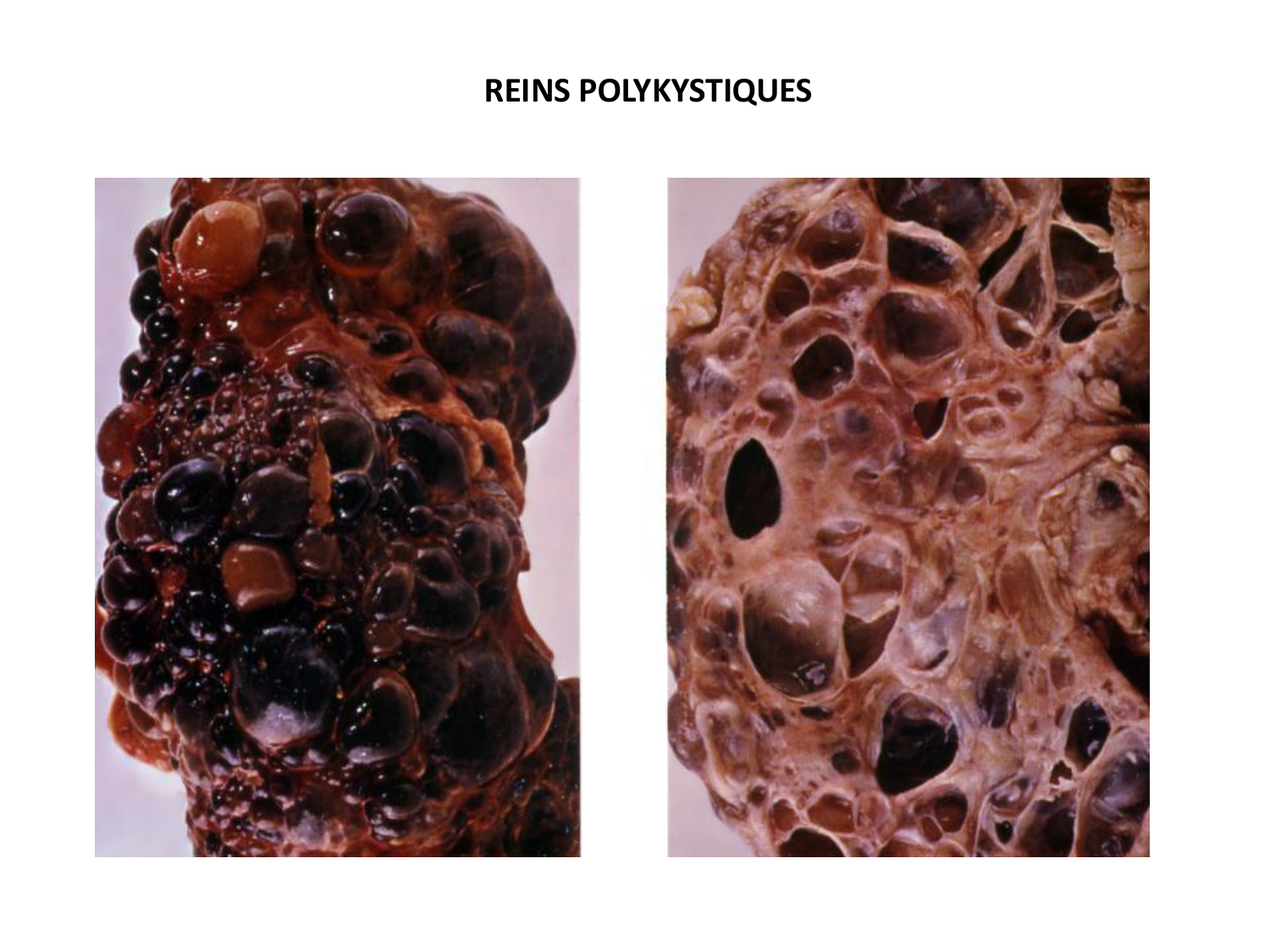 Développement du système urinaire page 62