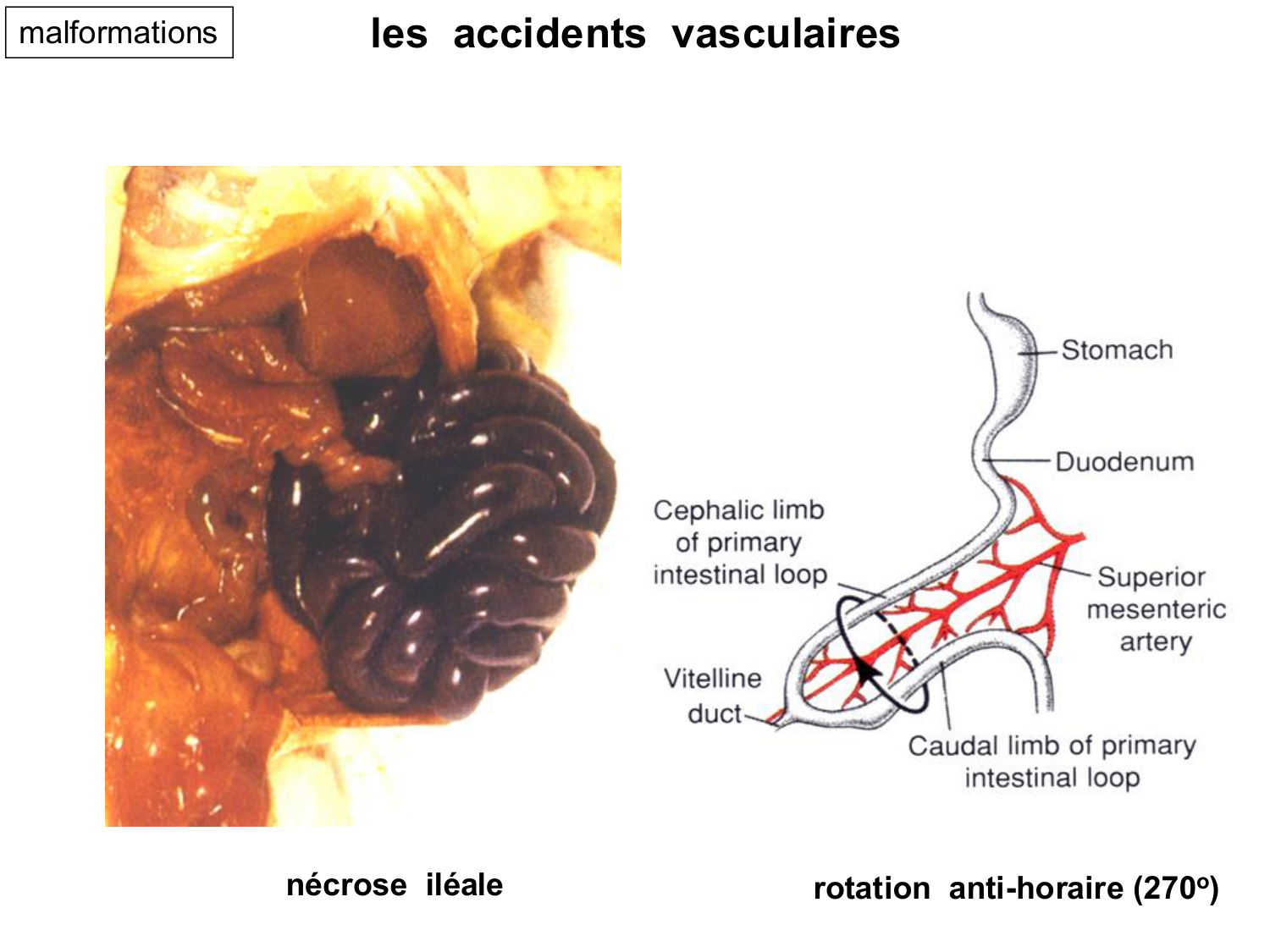 Développement du système digestif page 33