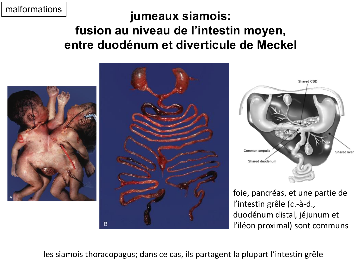 Développement du système digestif page 35