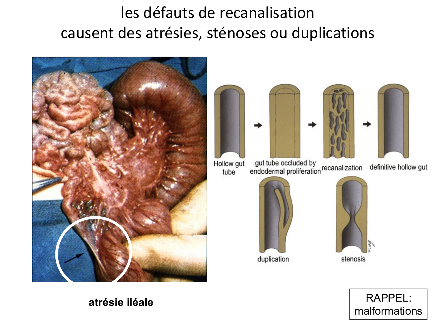 Développement du système digestif page 37