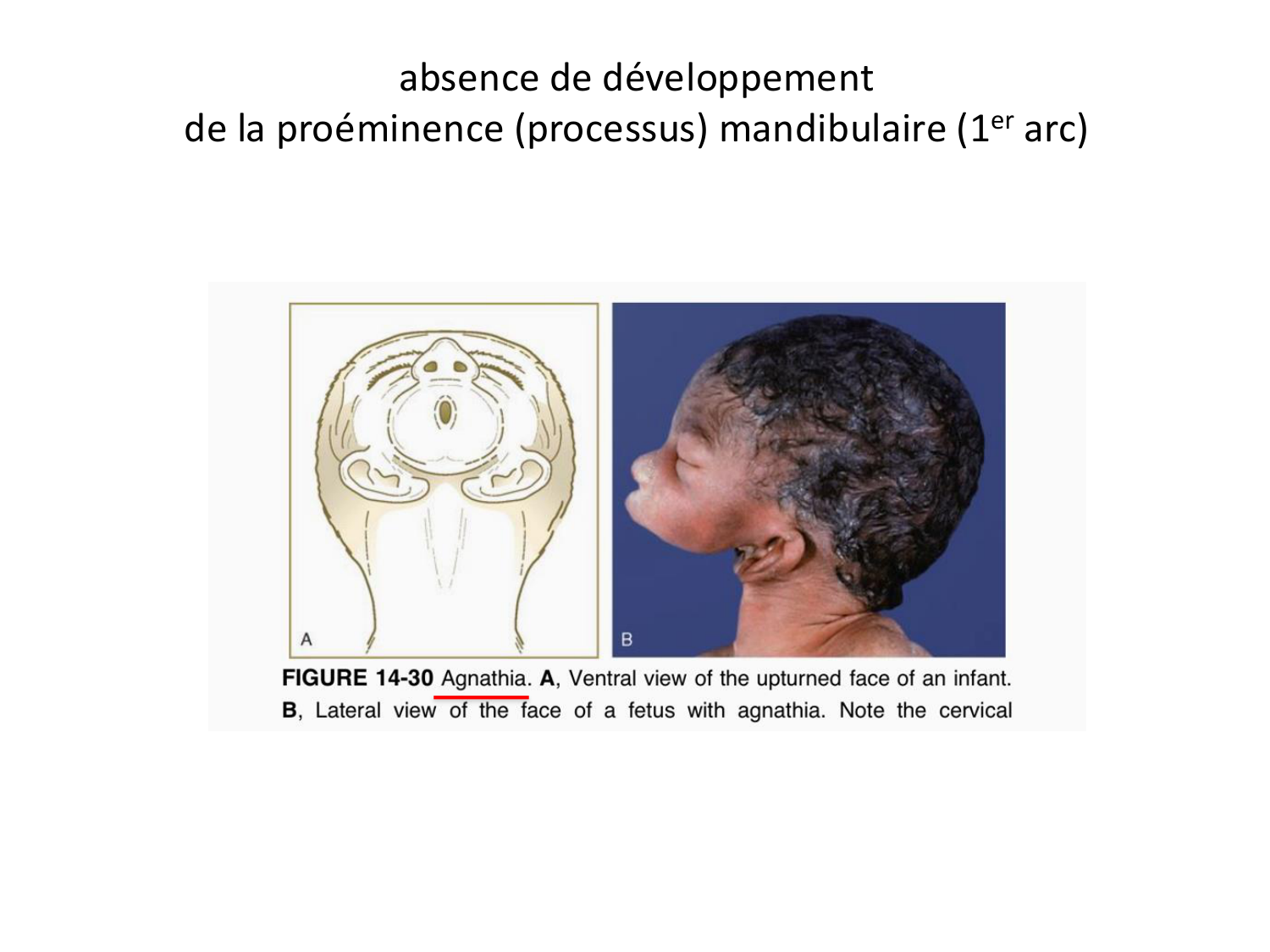 Face, arcs branchiaux et système respiratoire page 57