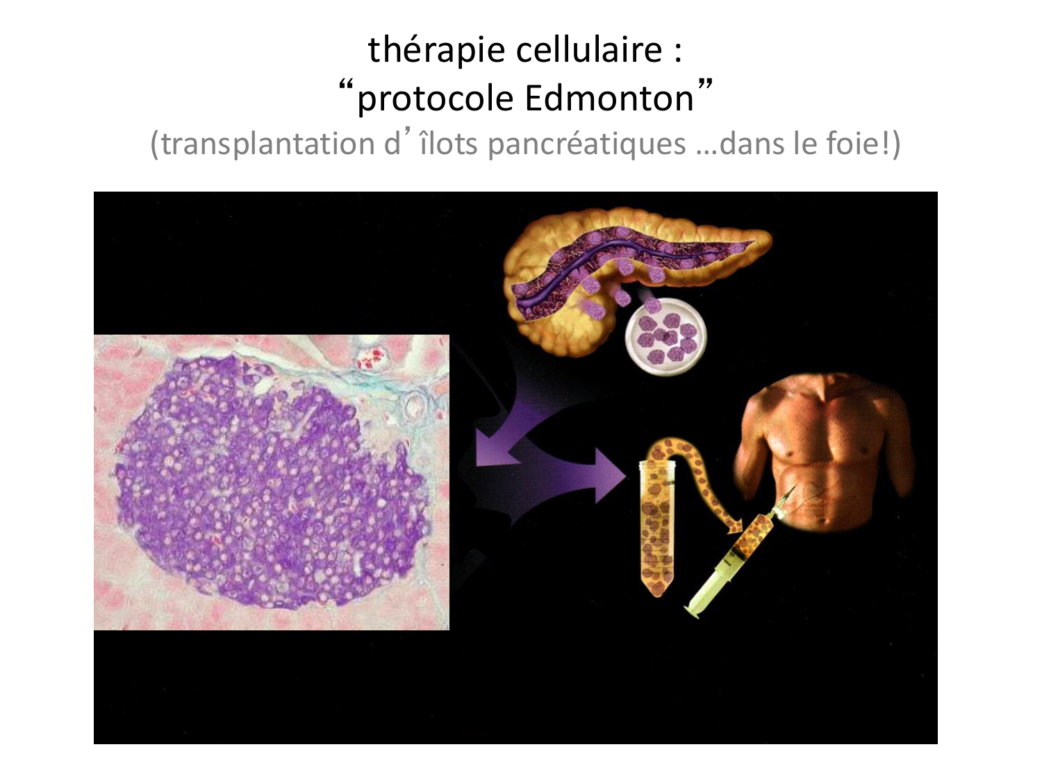Cellules souches et thérapie cellulaire page 23