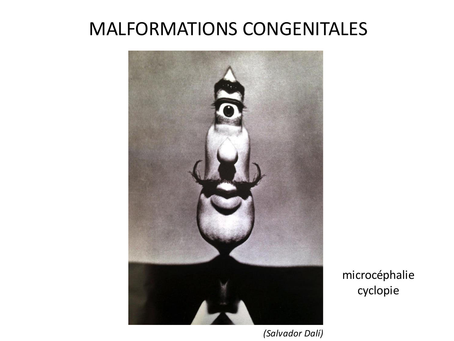 Malformations congénitales page 1