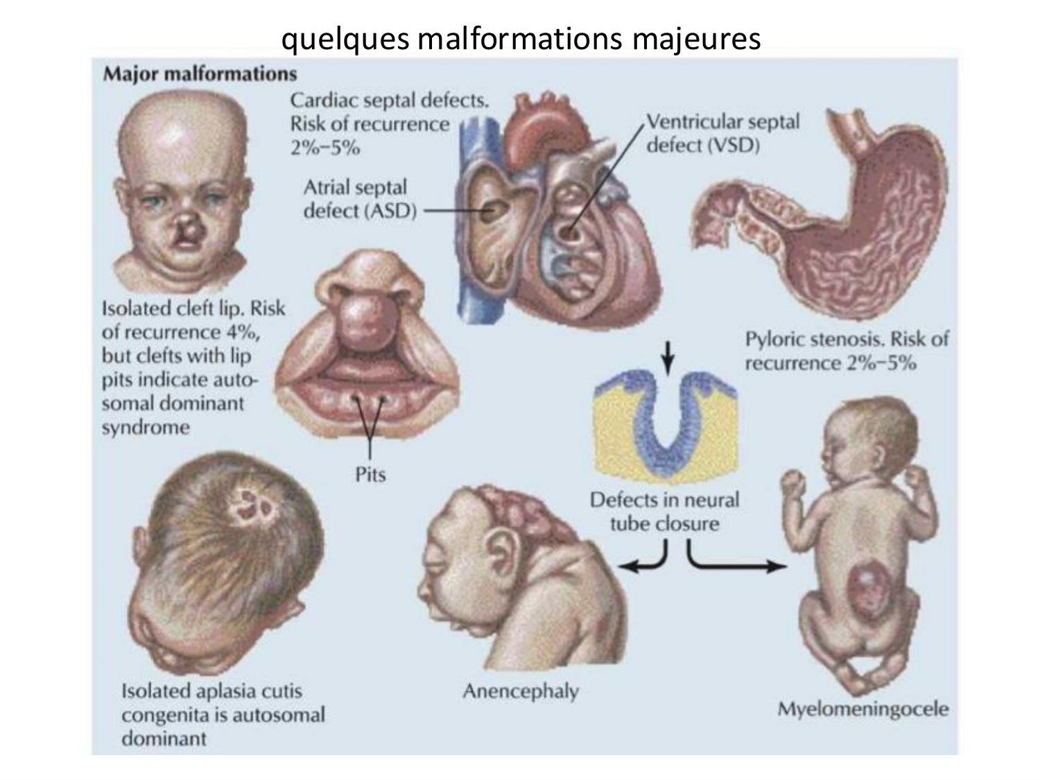 Malformations congénitales page 7