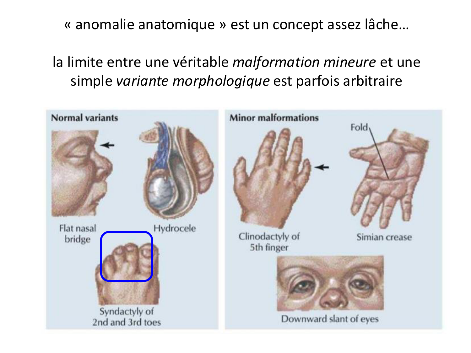 Malformations congénitales page 8