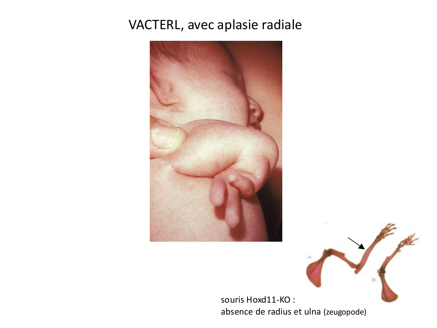 Malformations congénitales page 11