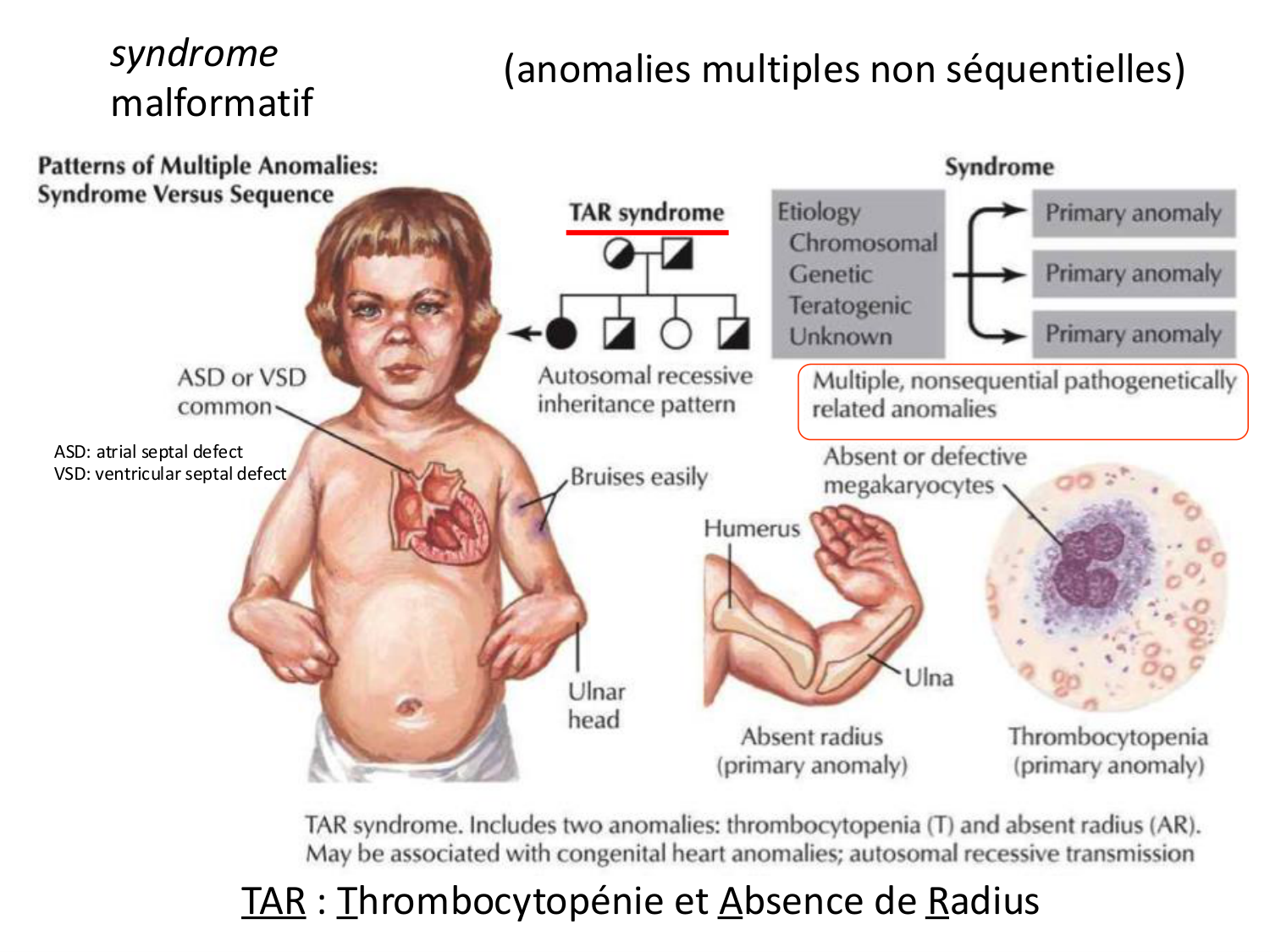 Malformations congénitales page 12