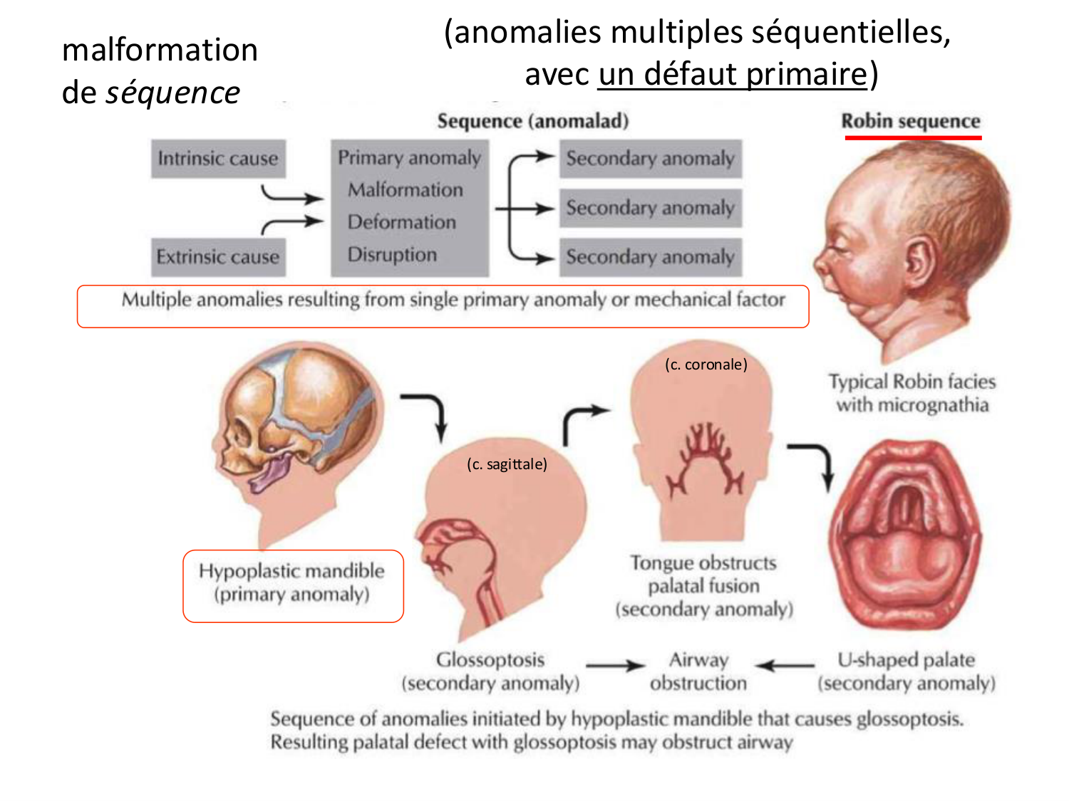 Malformations congénitales page 13