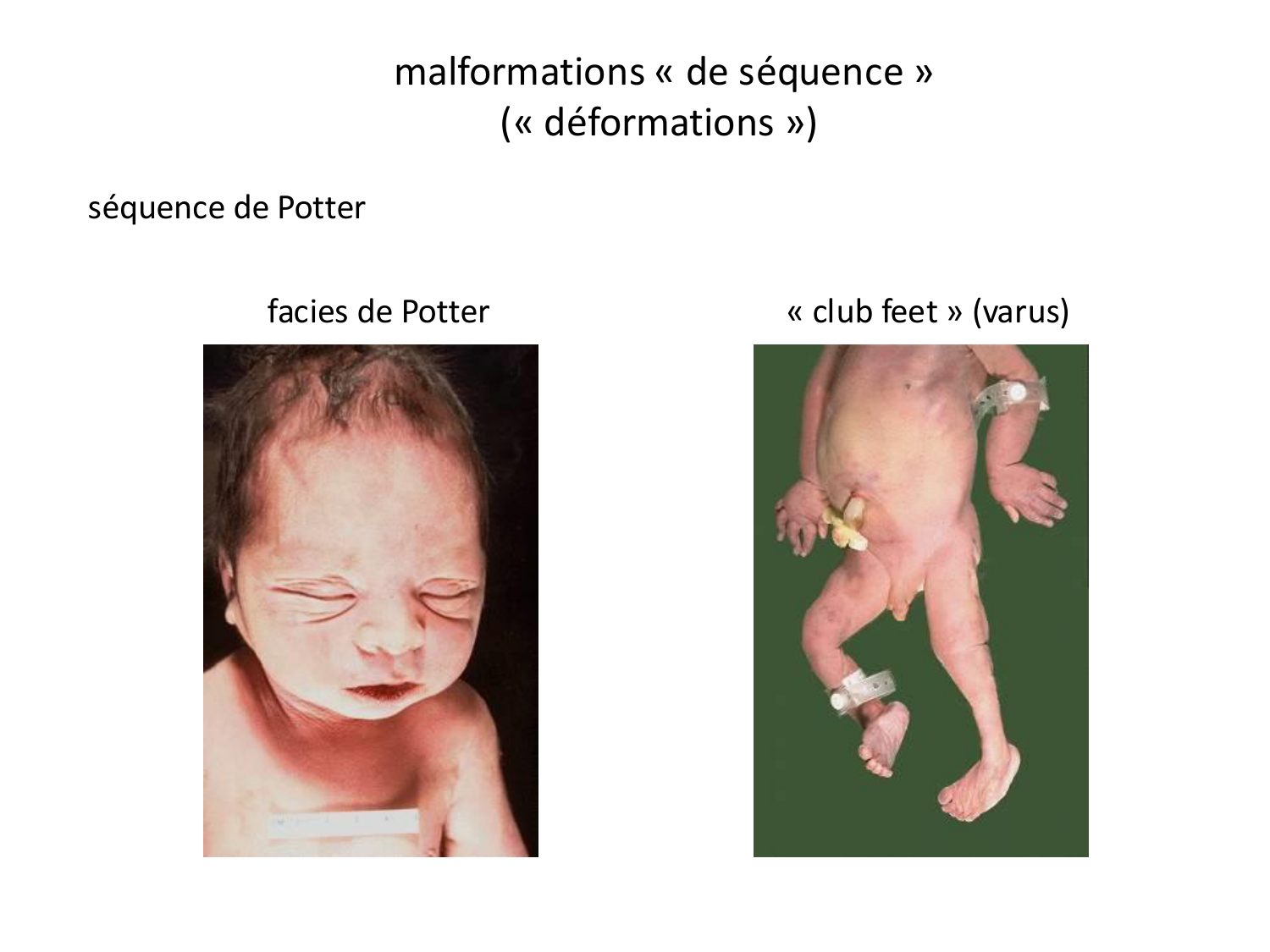 Malformations congénitales page 14