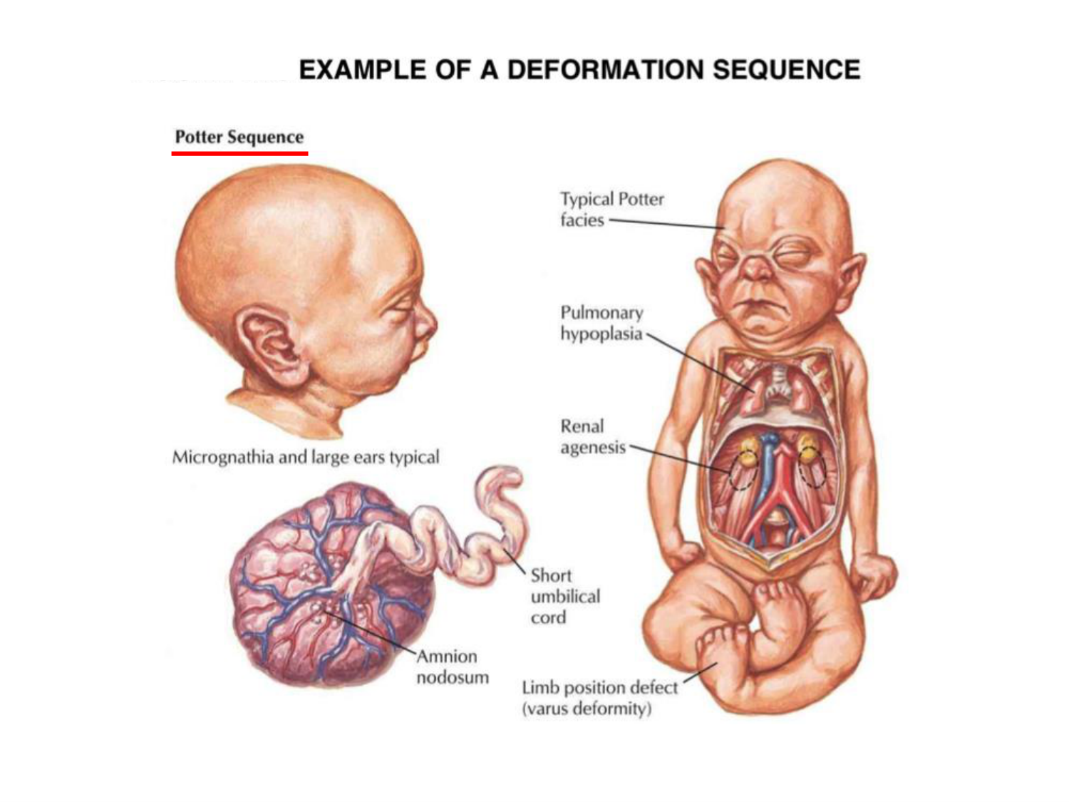 Malformations congénitales page 15