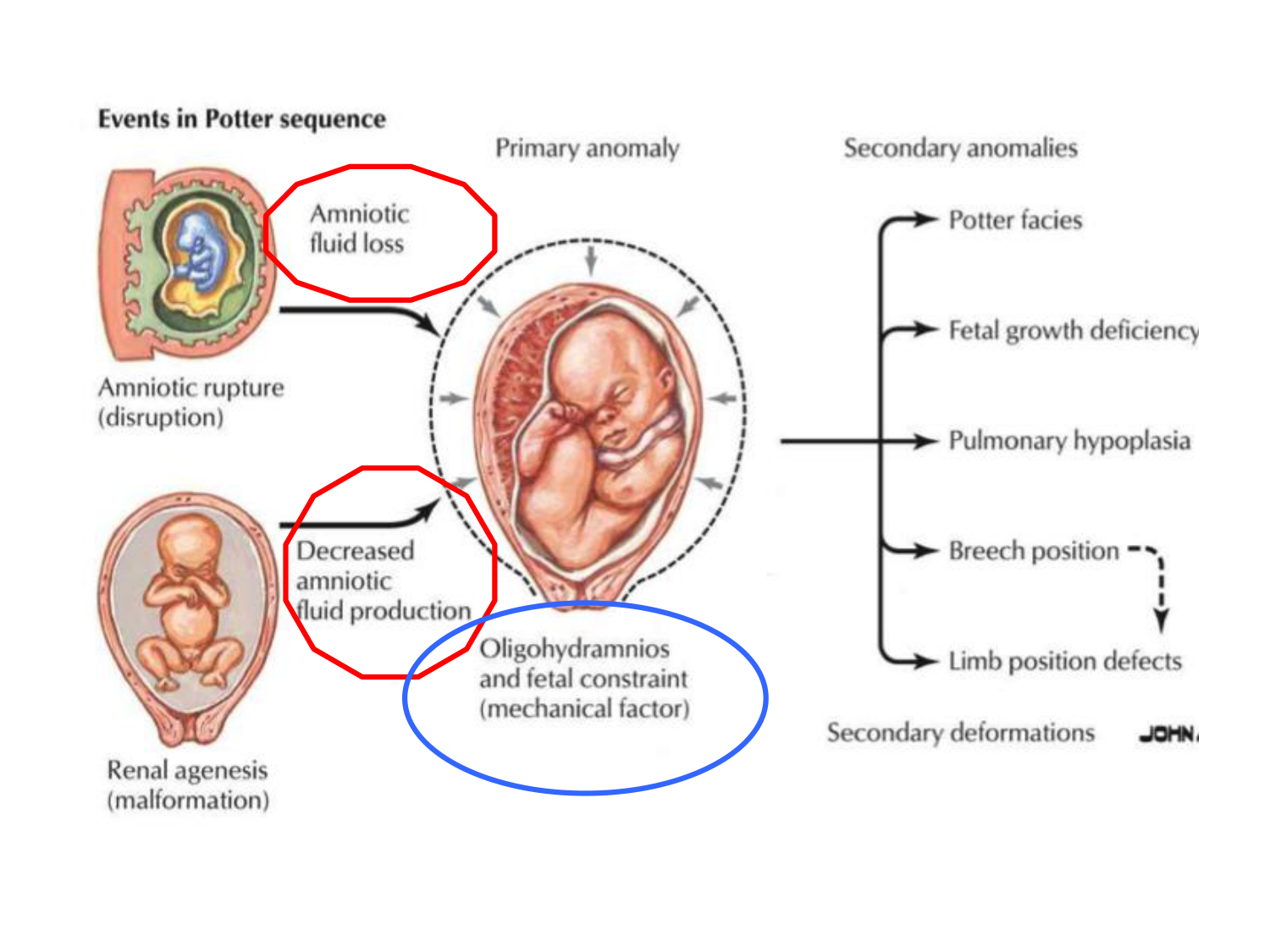 Malformations congénitales page 16