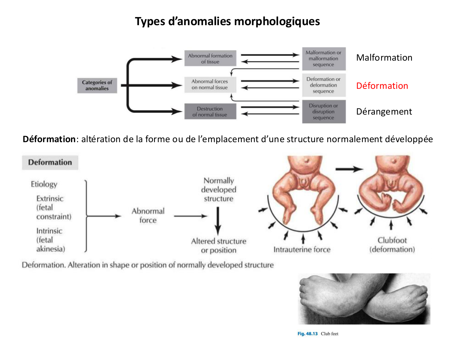 Malformations congénitales page 19