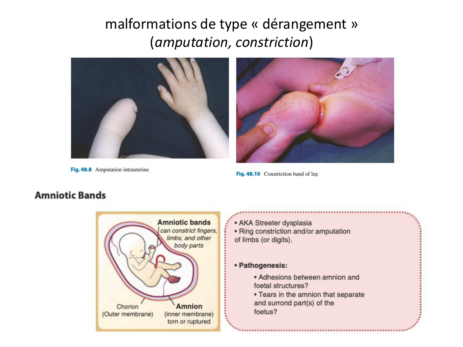 Malformations congénitales page 21