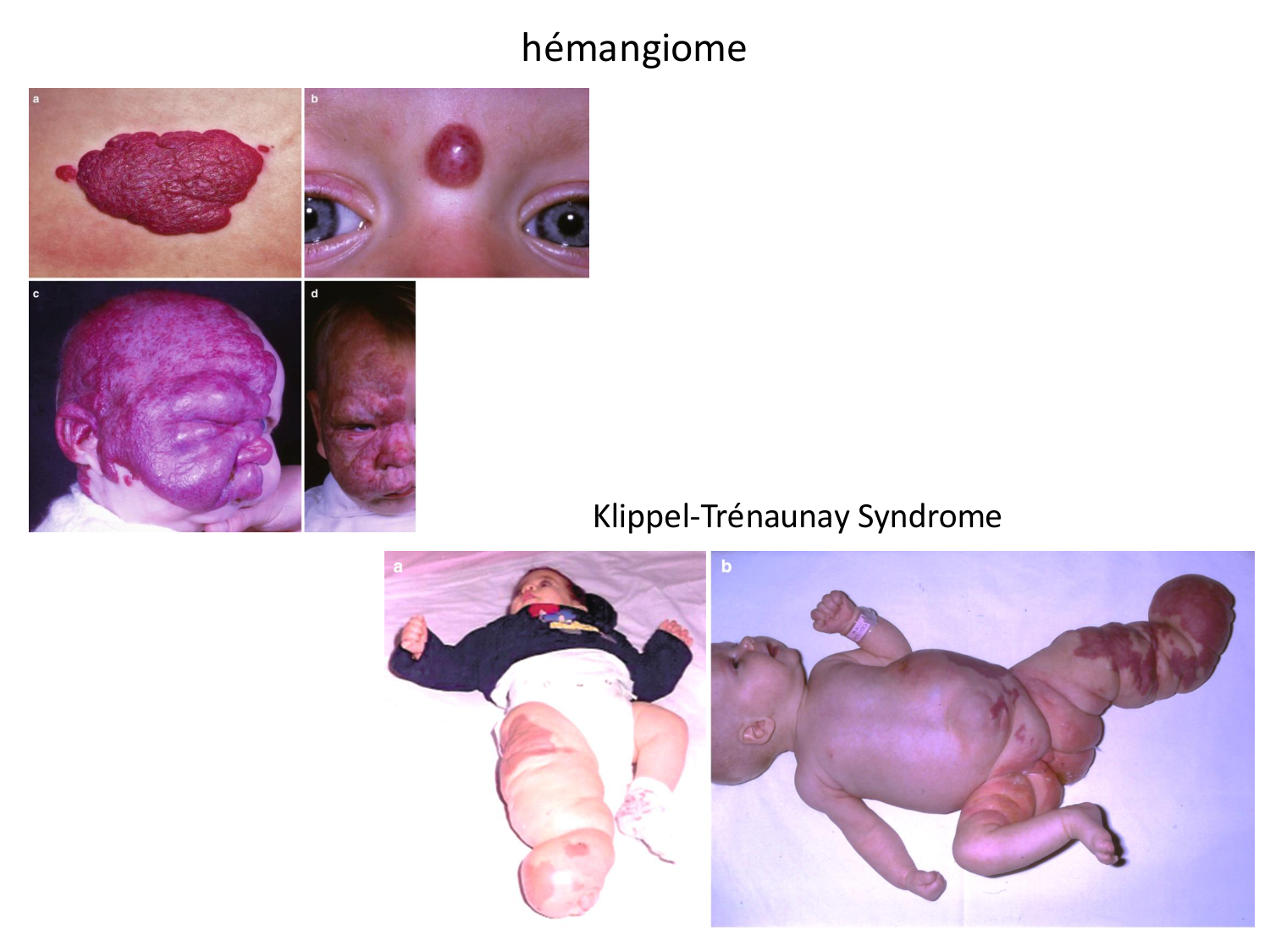 Malformations congénitales page 23