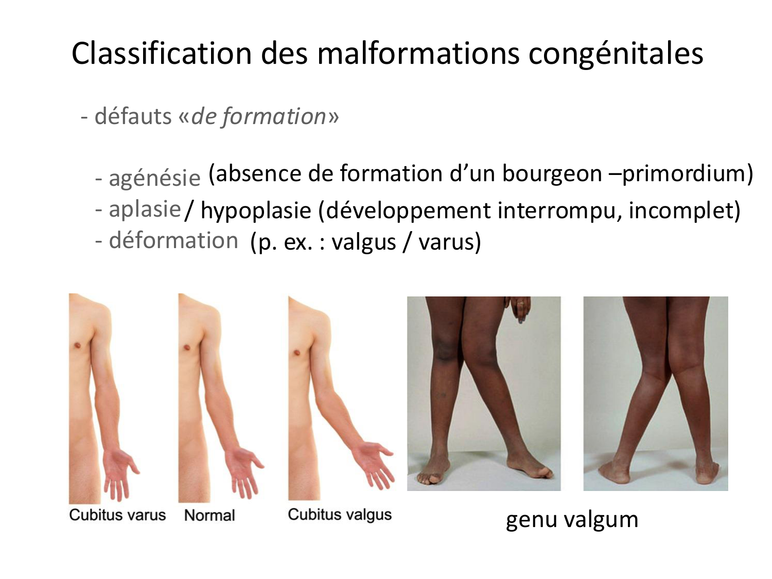 Malformations congénitales page 24
