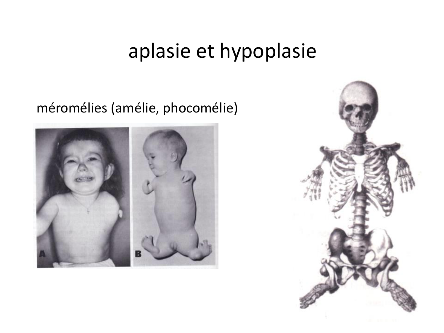 Malformations congénitales page 25