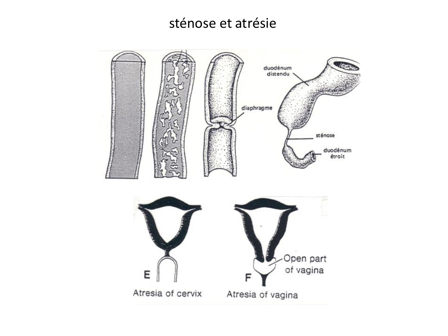 Malformations congénitales page 28