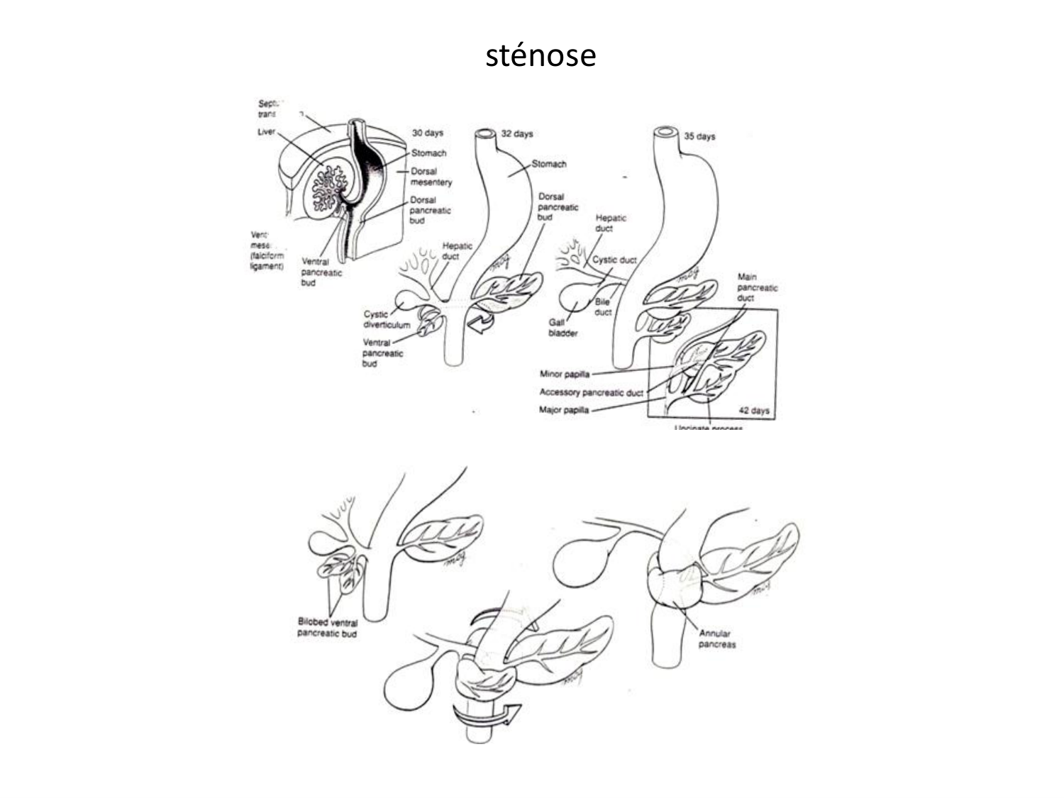Malformations congénitales page 29