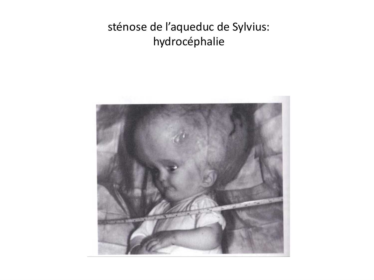 Malformations congénitales page 31