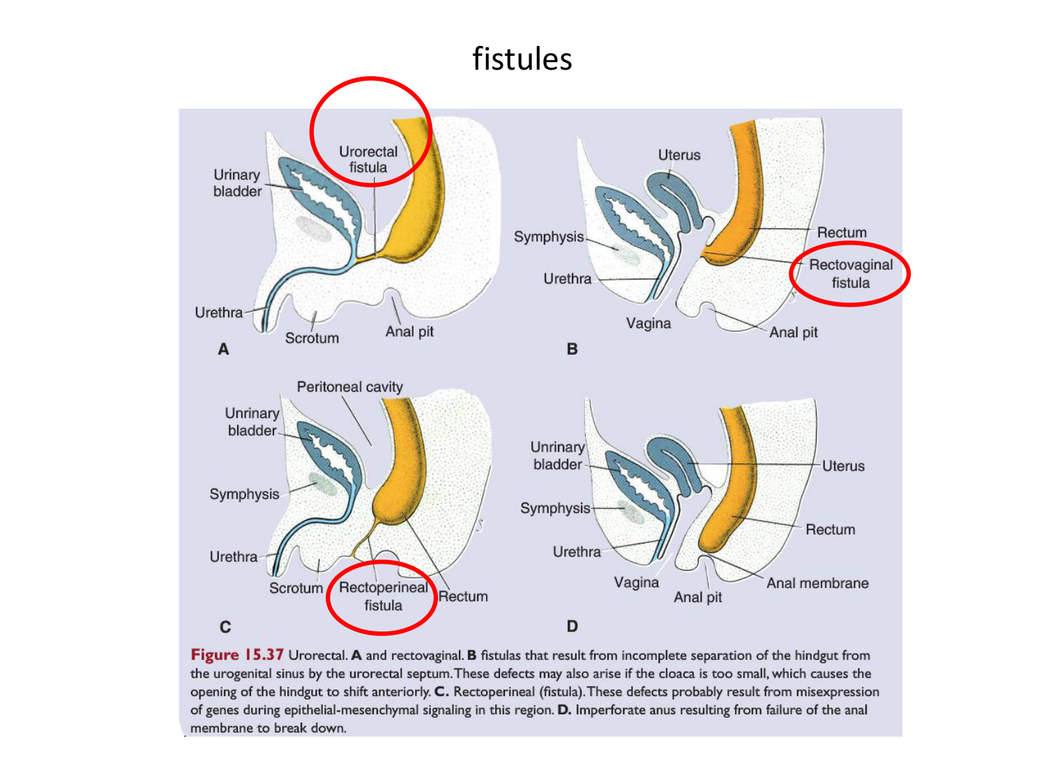 Malformations congénitales page 33