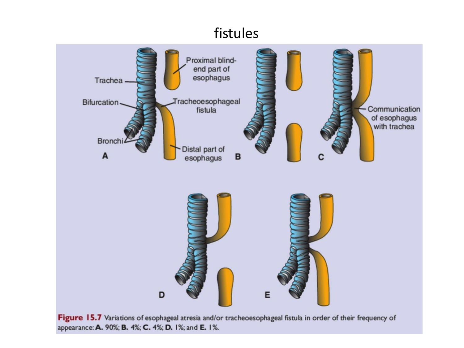 Malformations congénitales page 34