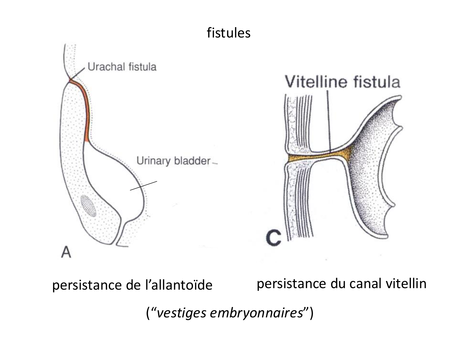 Malformations congénitales page 35