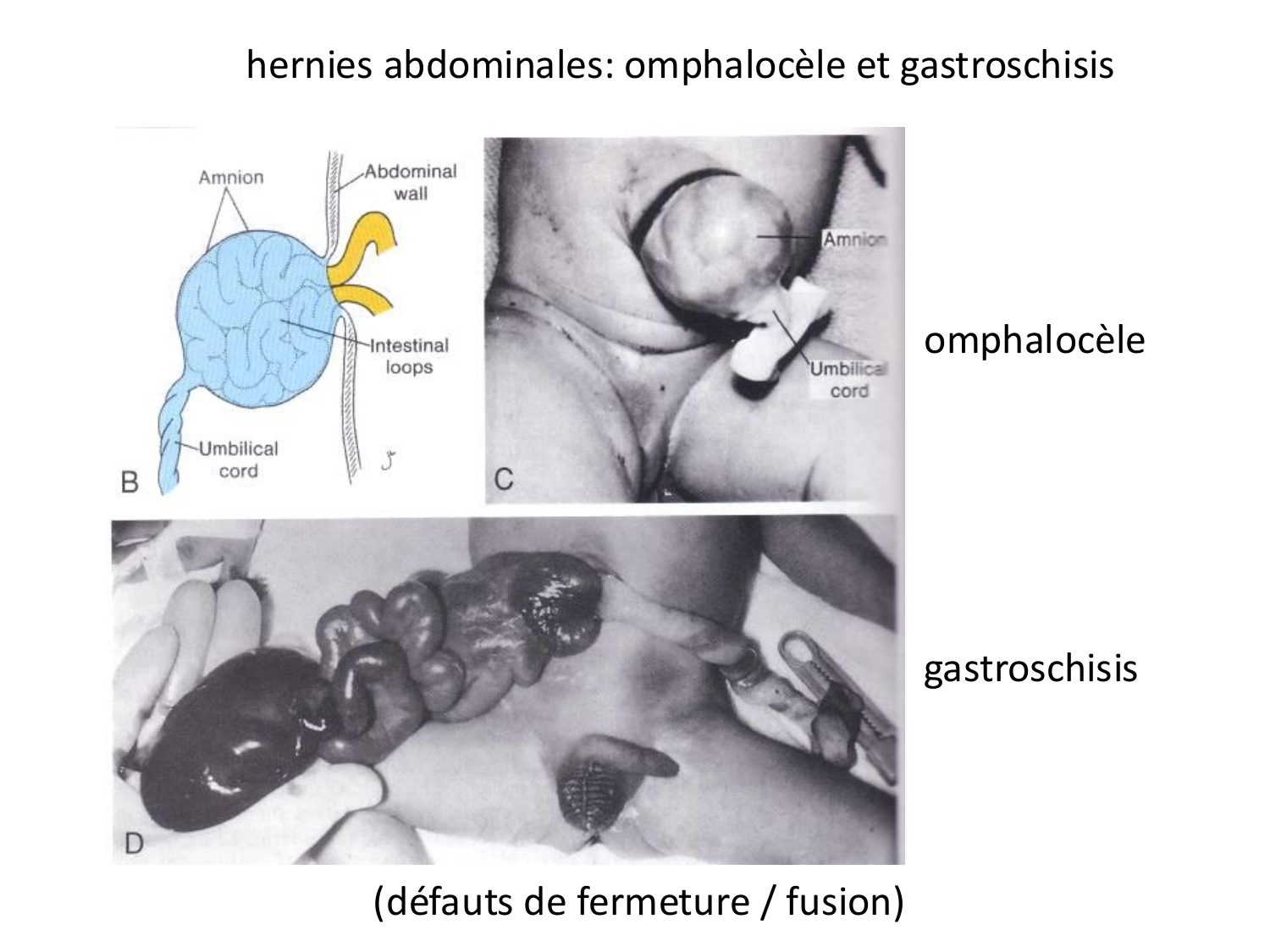 Malformations congénitales page 36