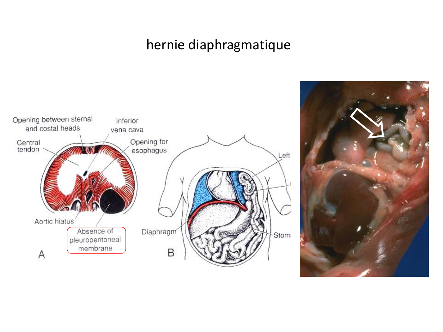 Malformations congénitales page 38