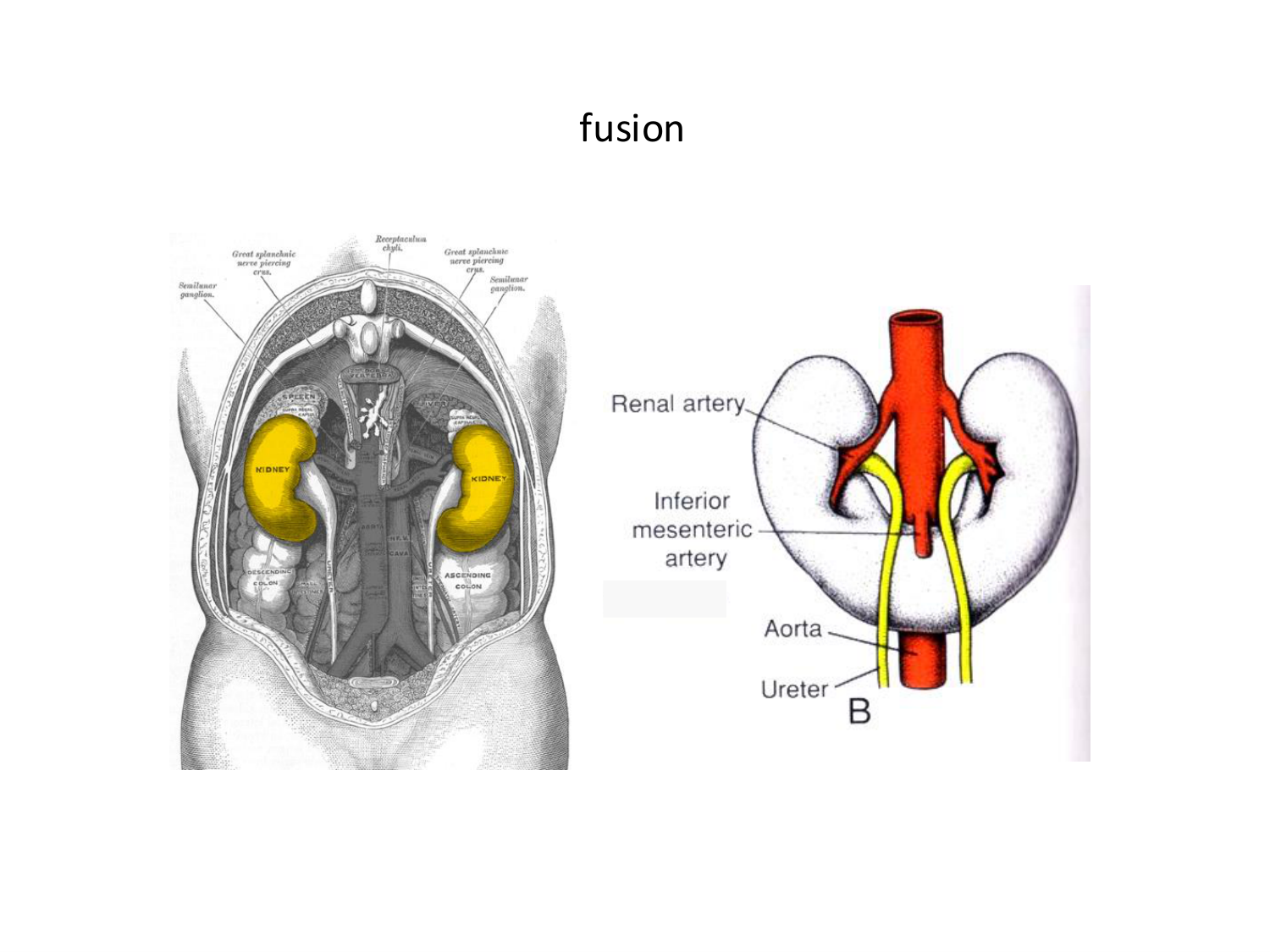 Malformations congénitales page 40