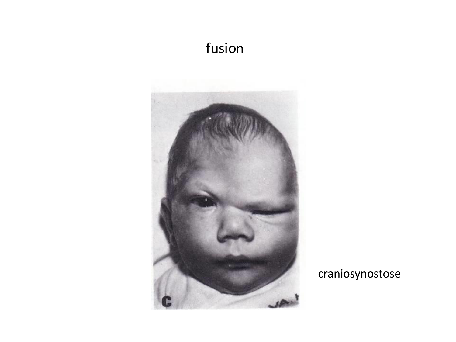 Malformations congénitales page 41