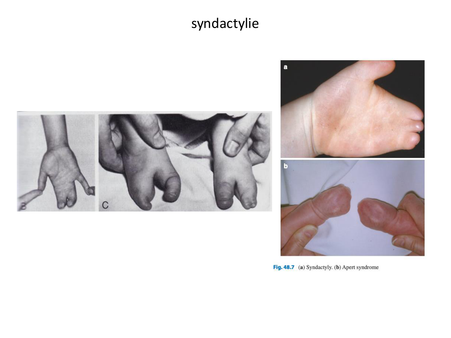 Malformations congénitales page 42
