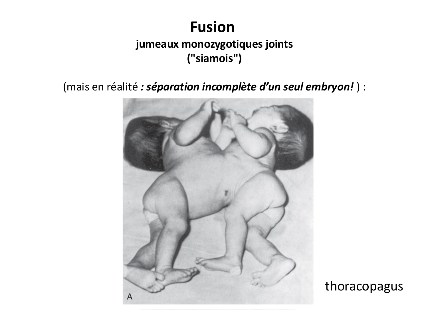 Malformations congénitales page 45