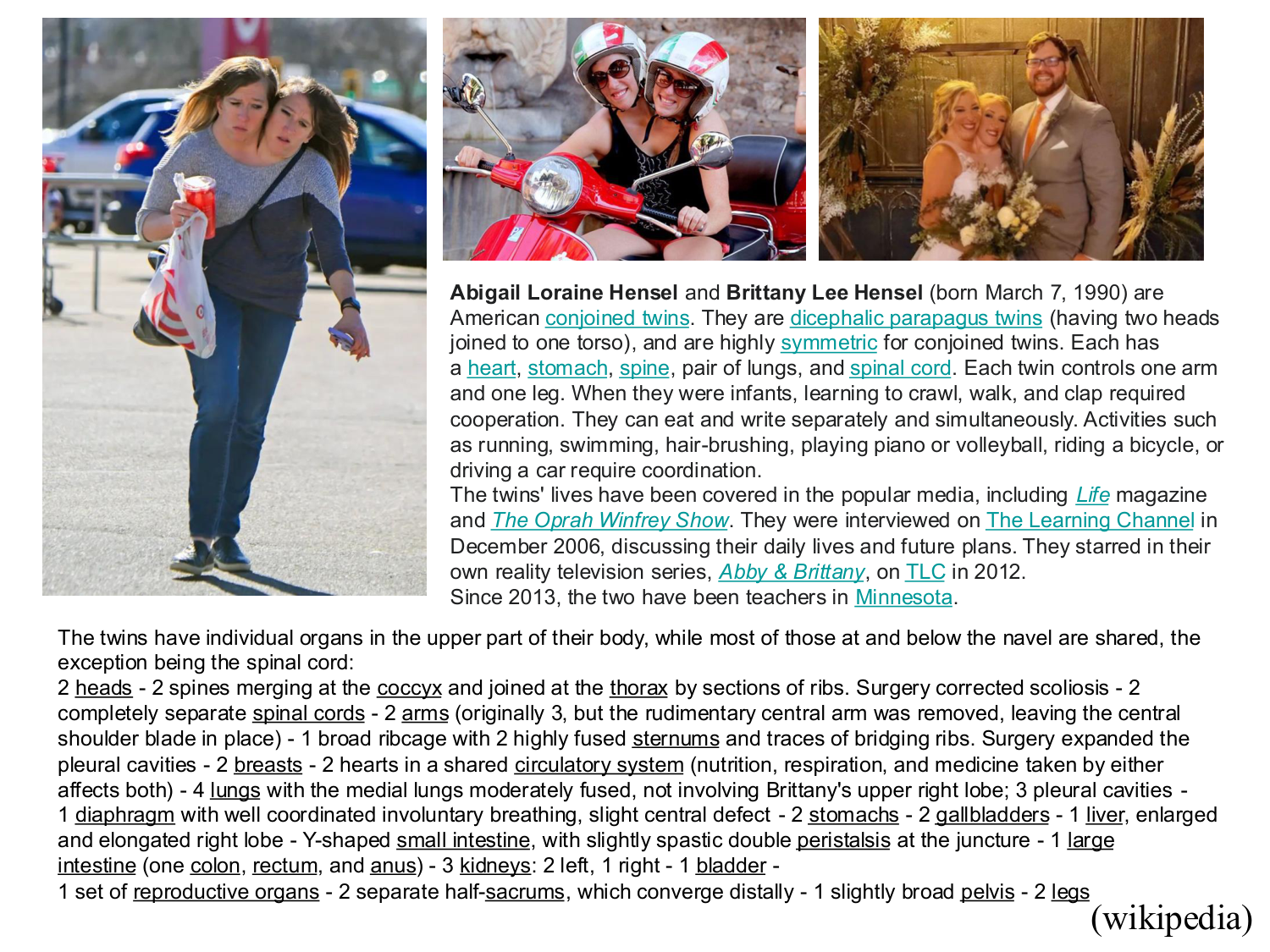 Malformations congénitales page 47