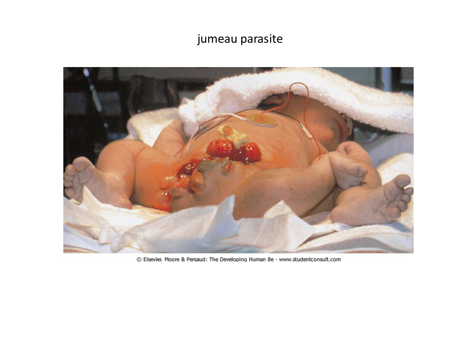 Malformations congénitales page 48