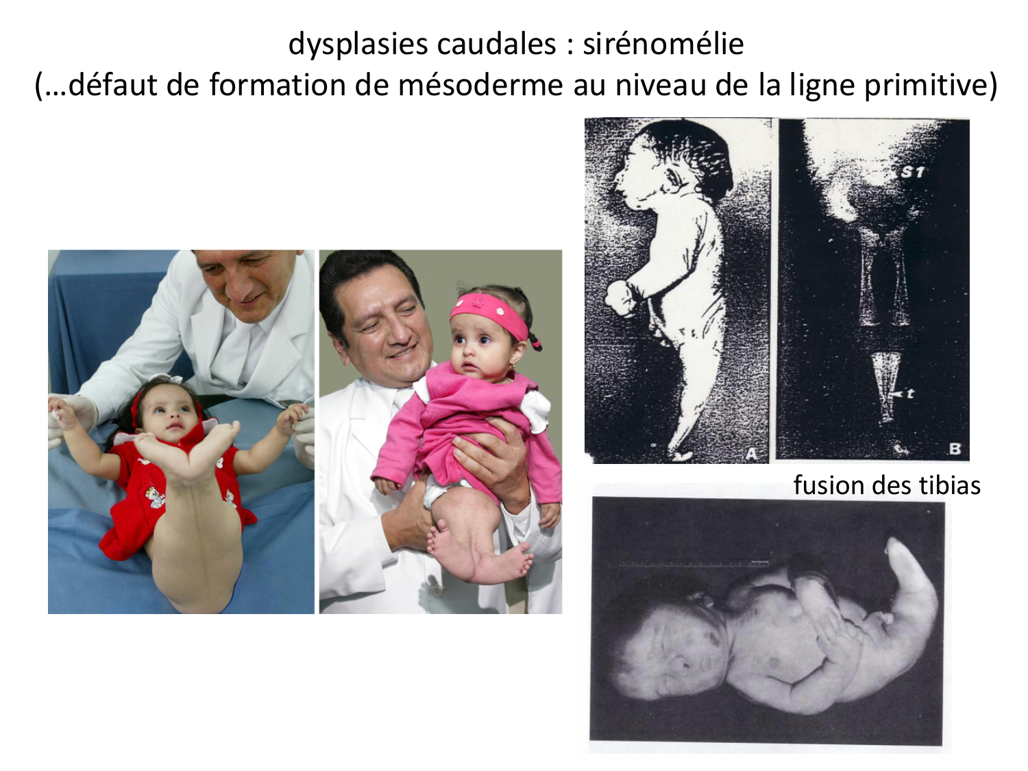 Malformations congénitales page 50