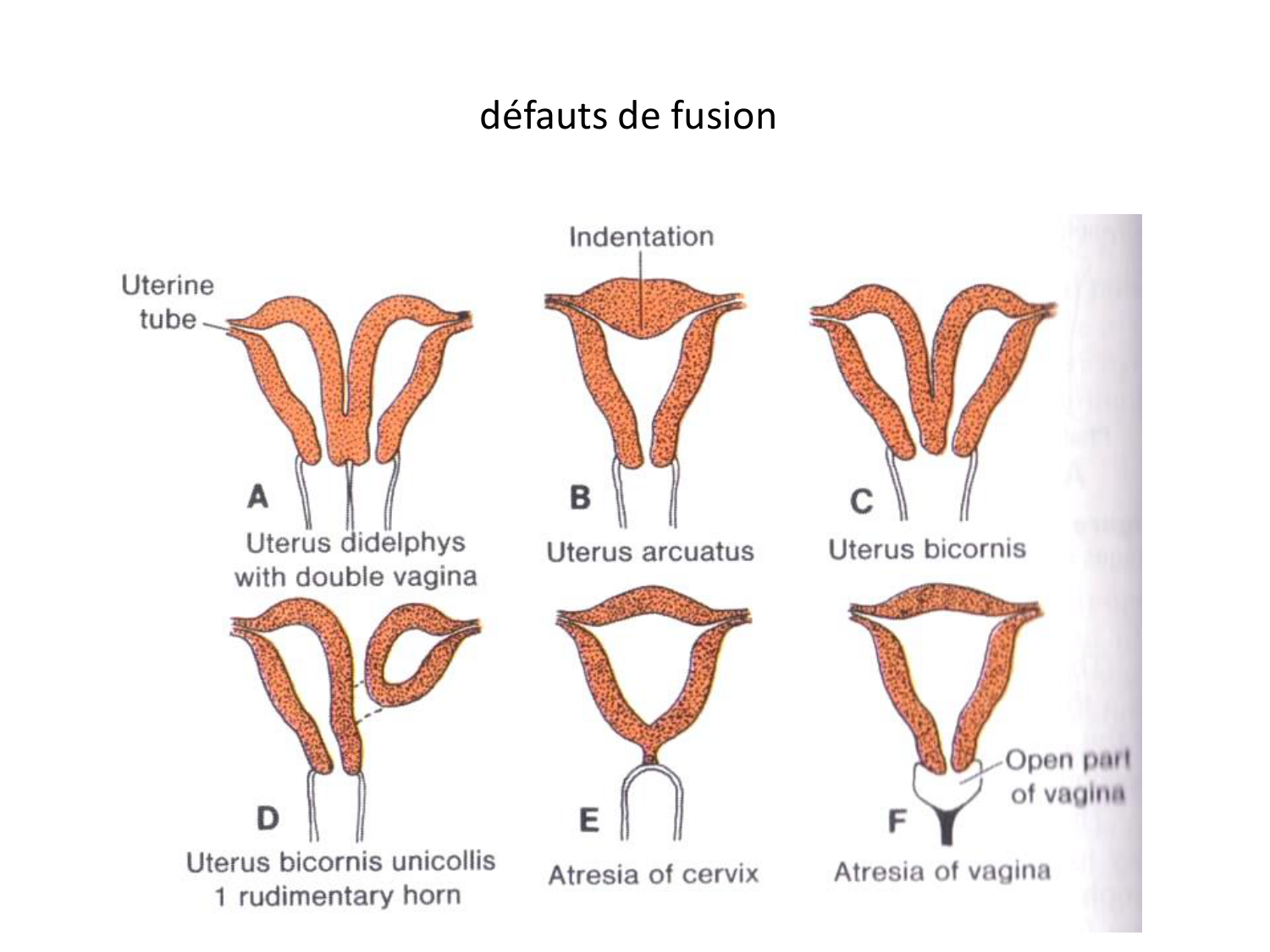 Malformations congénitales page 52