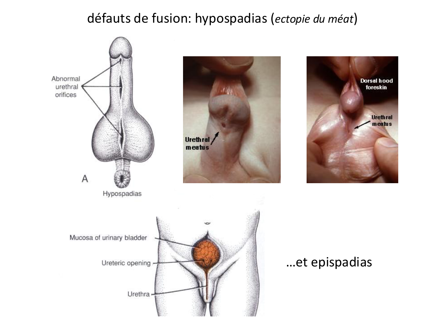 Malformations congénitales page 53