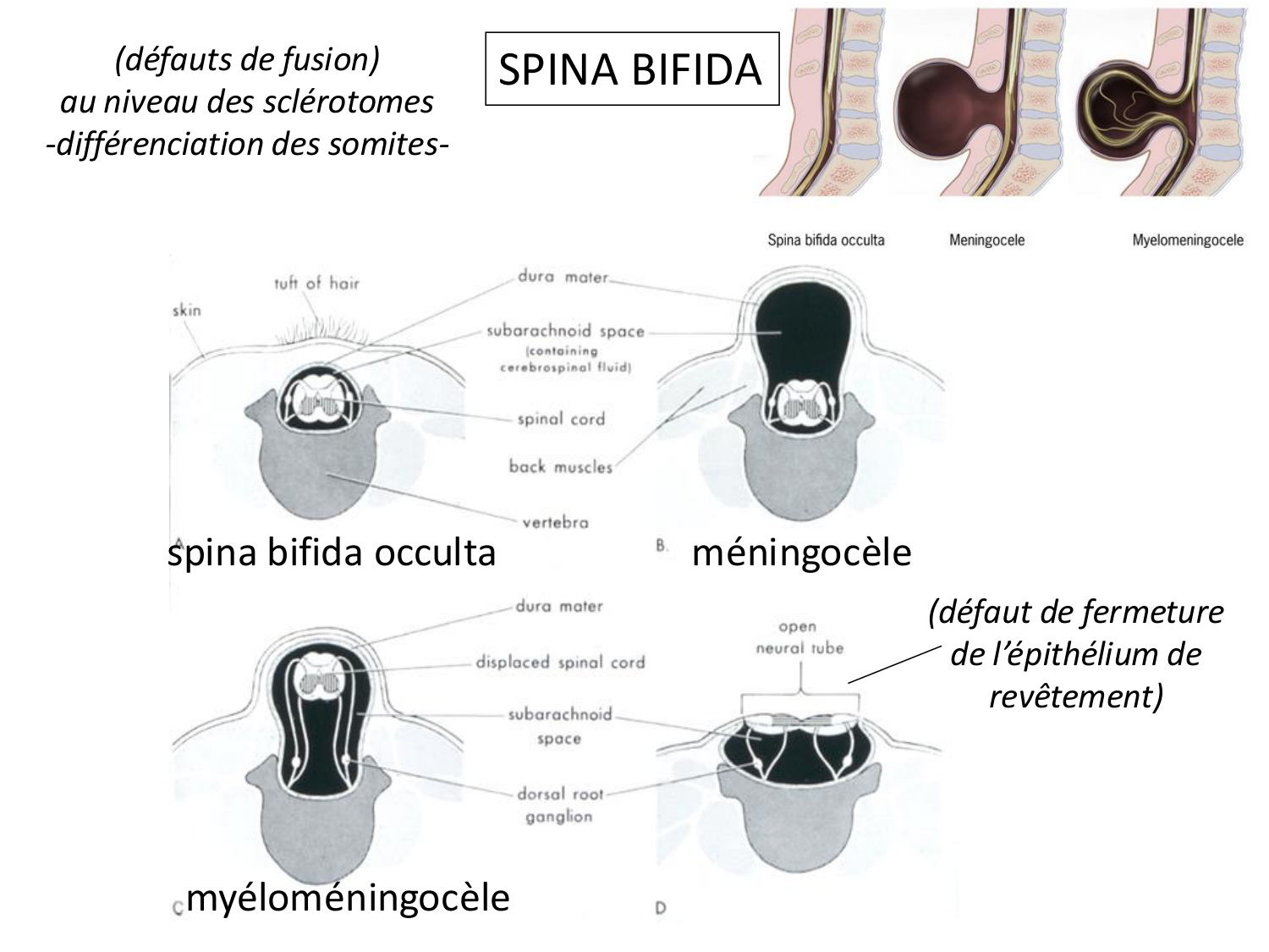 Malformations congénitales page 57