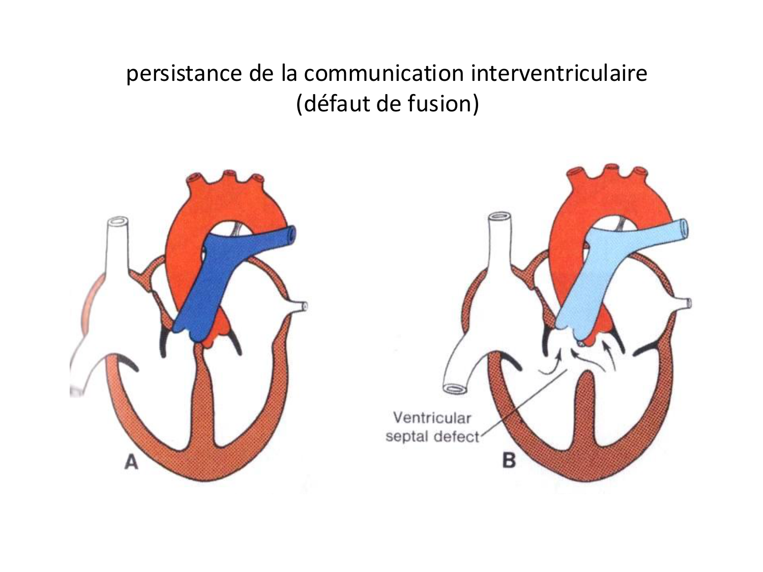 Malformations congénitales page 59
