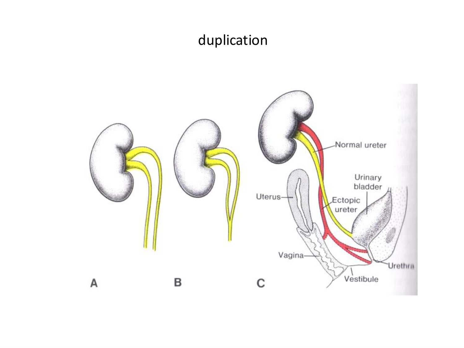 Malformations congénitales page 60