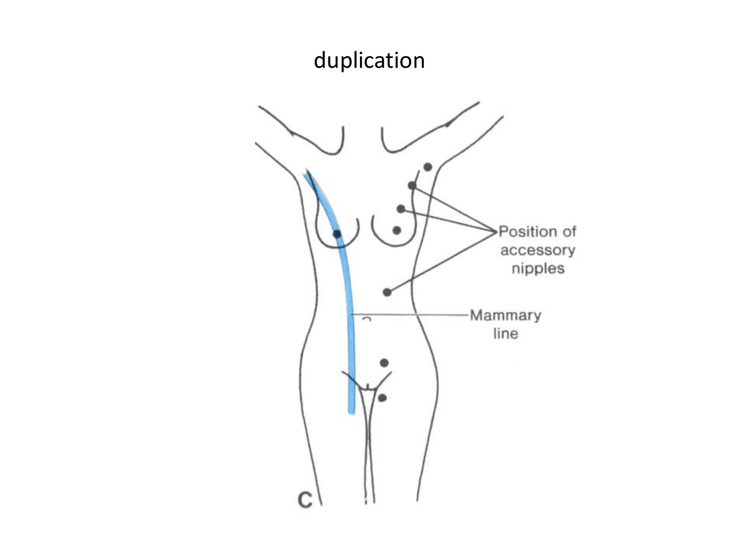 Malformations congénitales page 61