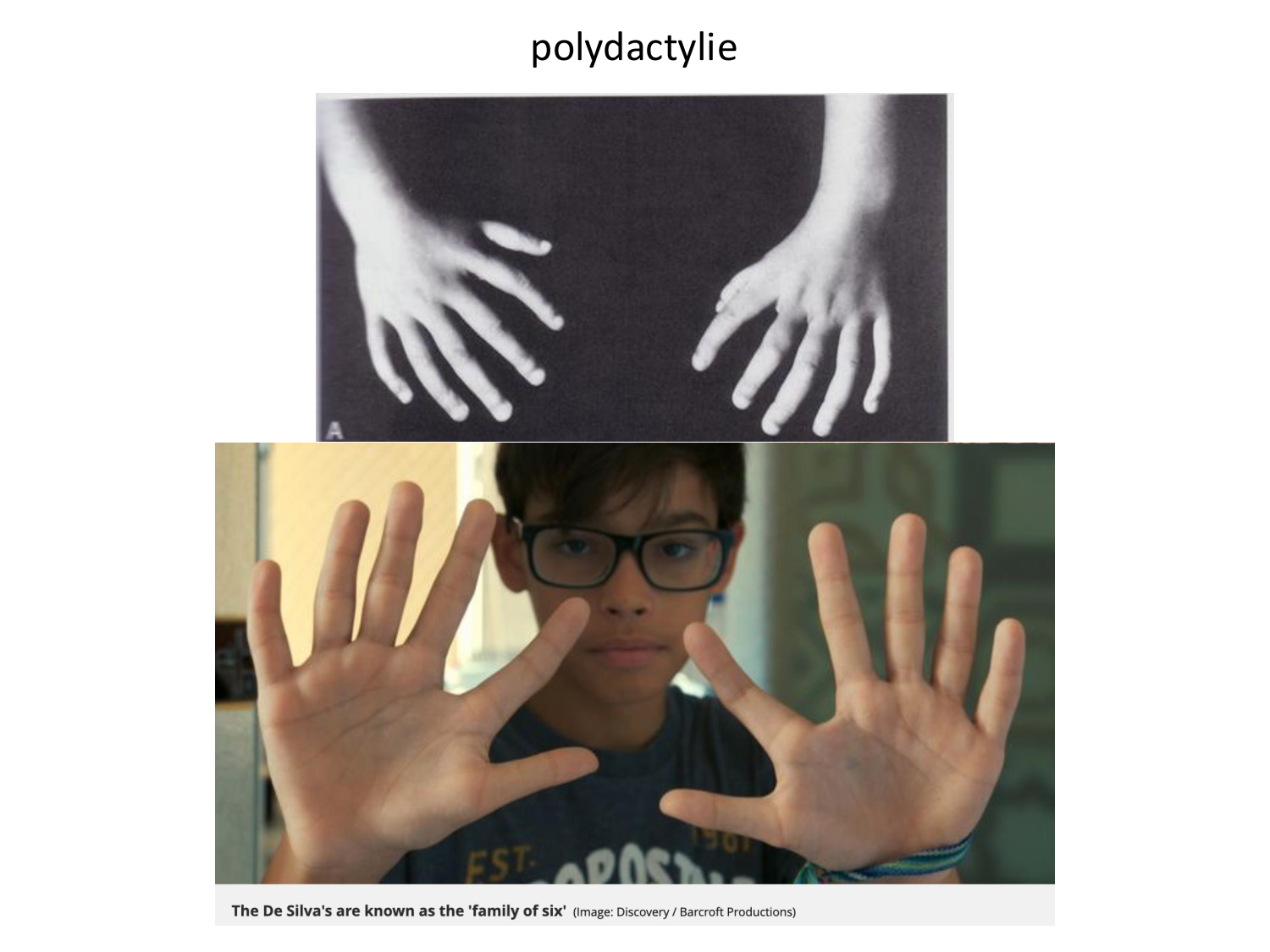 Malformations congénitales page 62