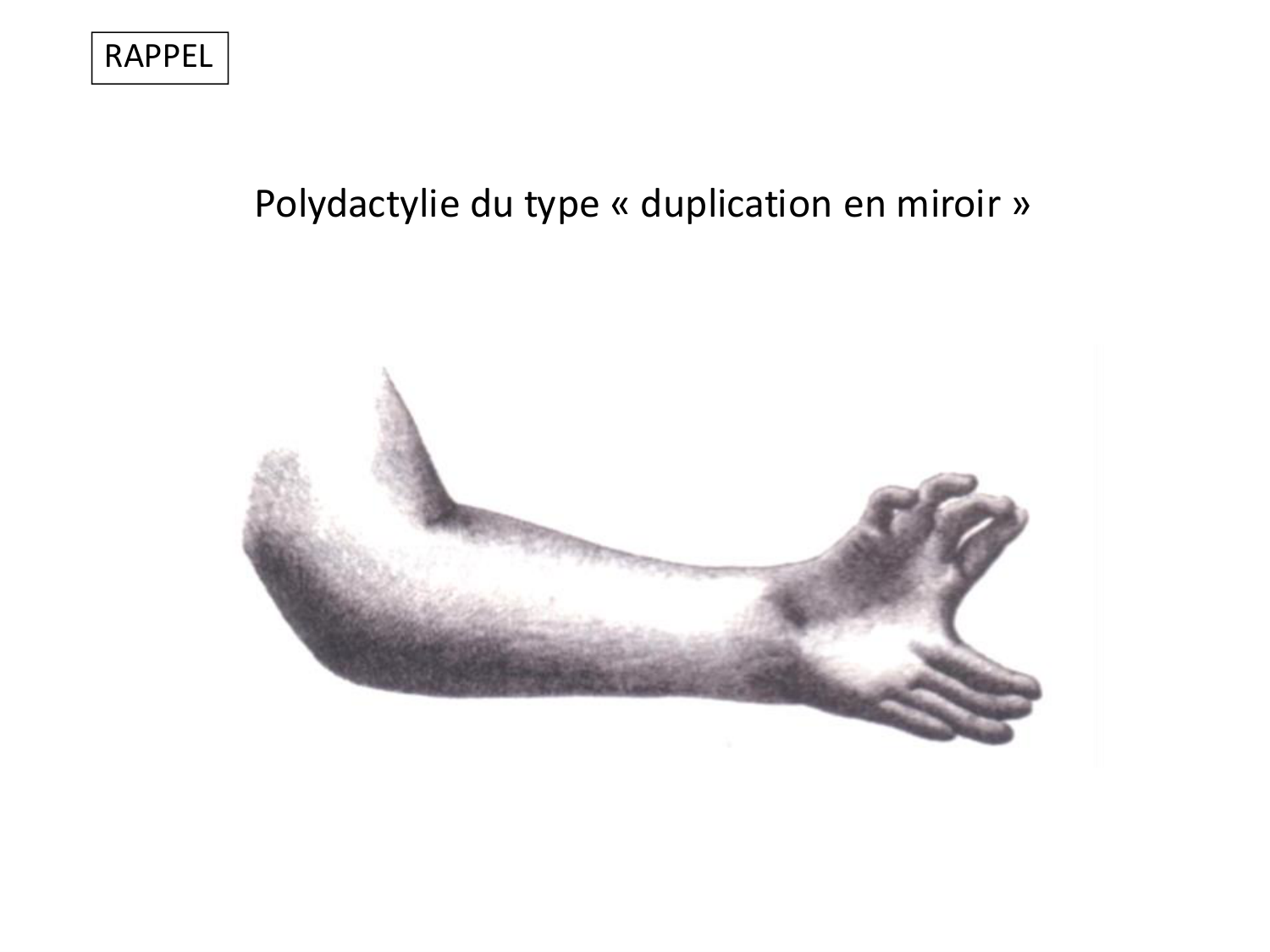 Malformations congénitales page 63