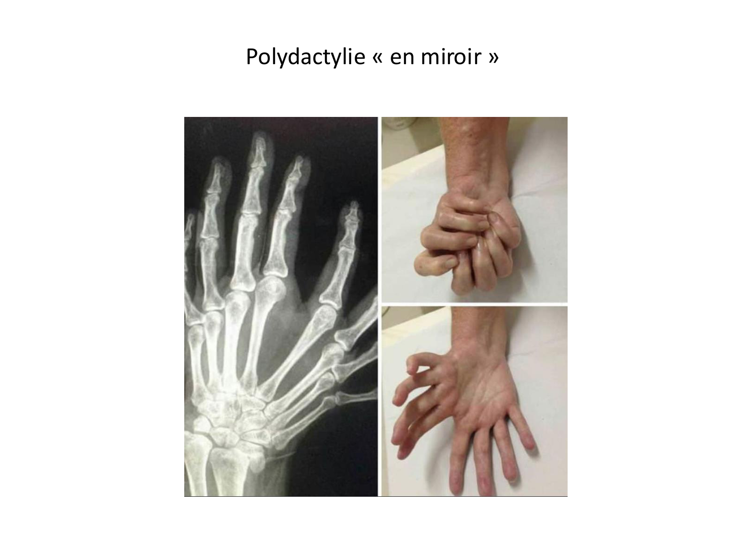 Malformations congénitales page 64