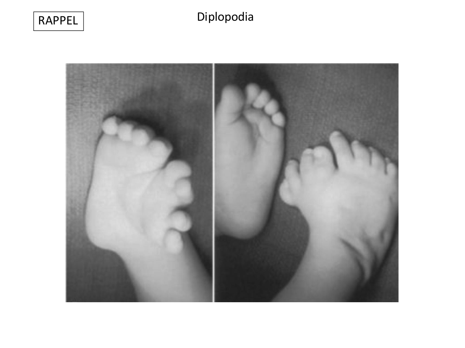 Malformations congénitales page 65