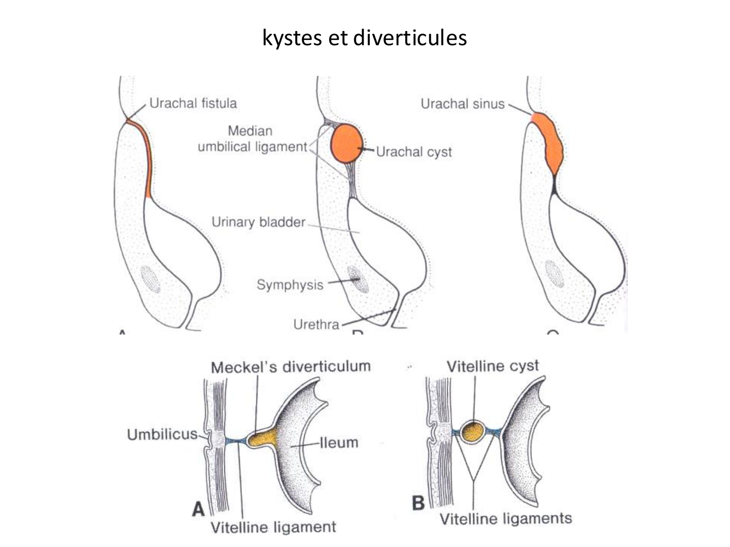 Malformations congénitales page 69