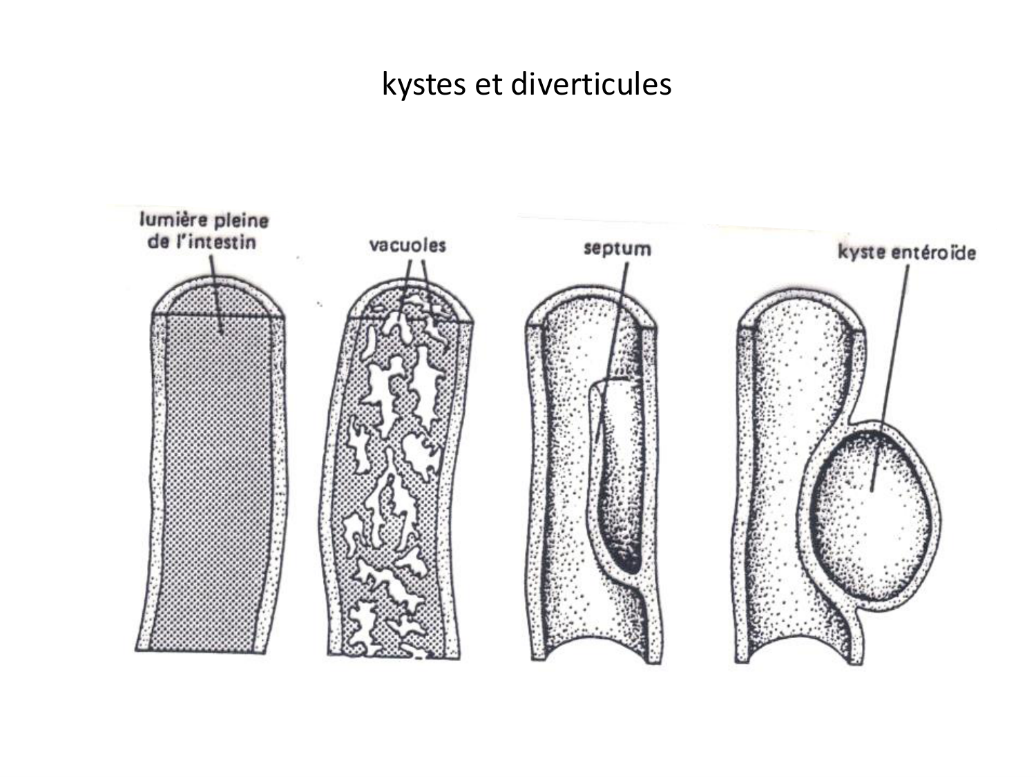 Malformations congénitales page 70