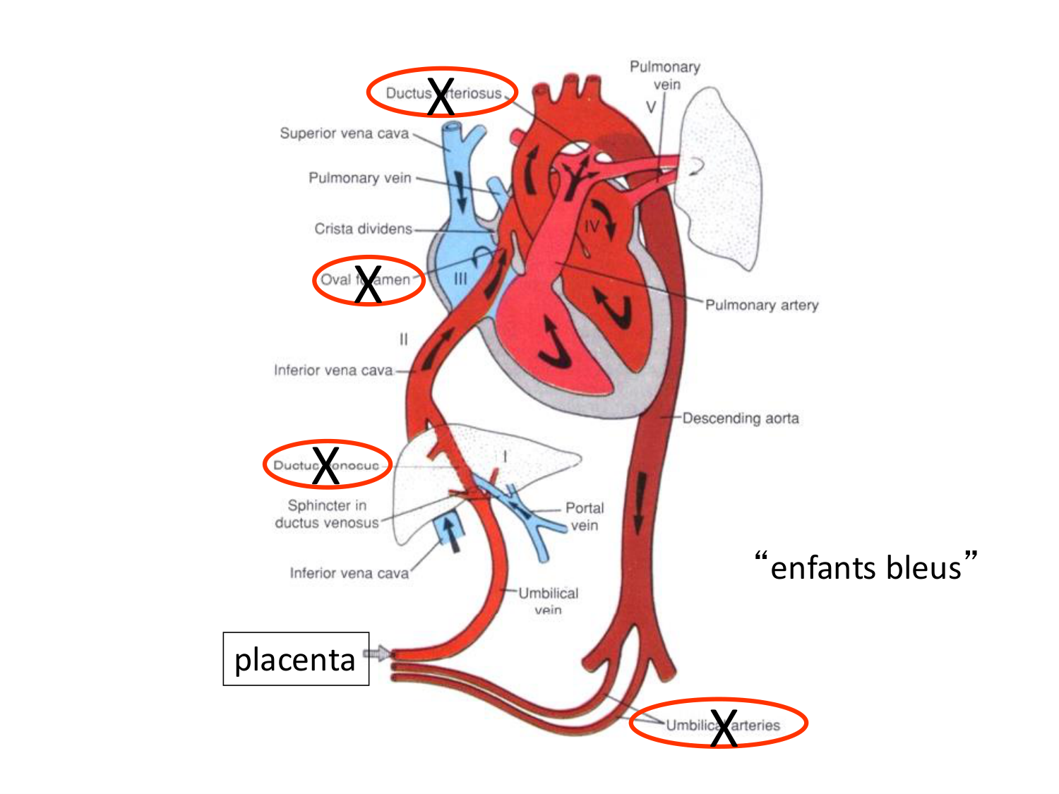 Malformations congénitales page 72