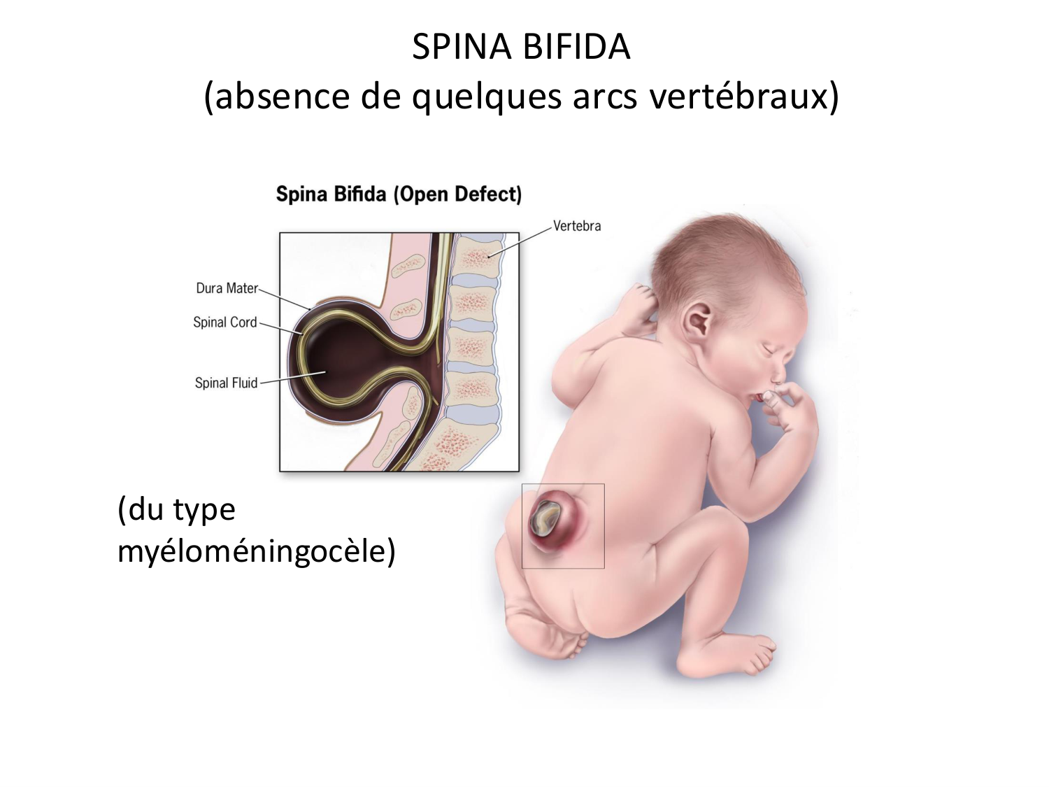 Malformations congénitales page 74