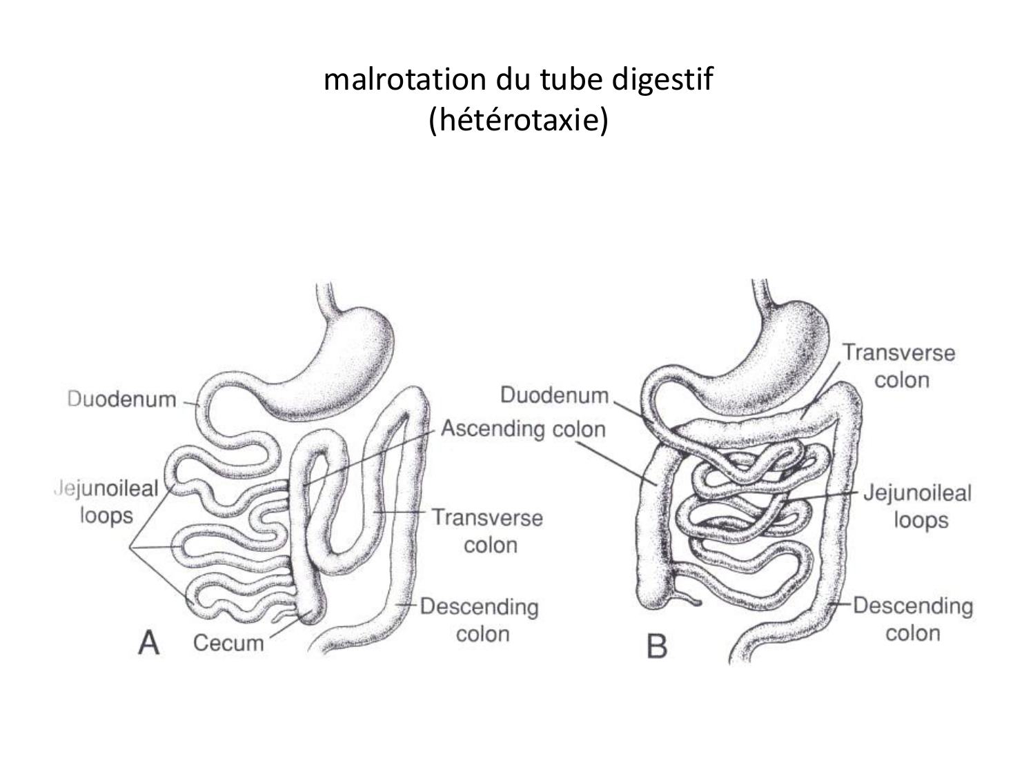 Malformations congénitales page 77